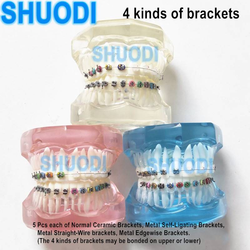 Стоматологическая Ортодонтическая модель зубов 4 вида скоб керамические и